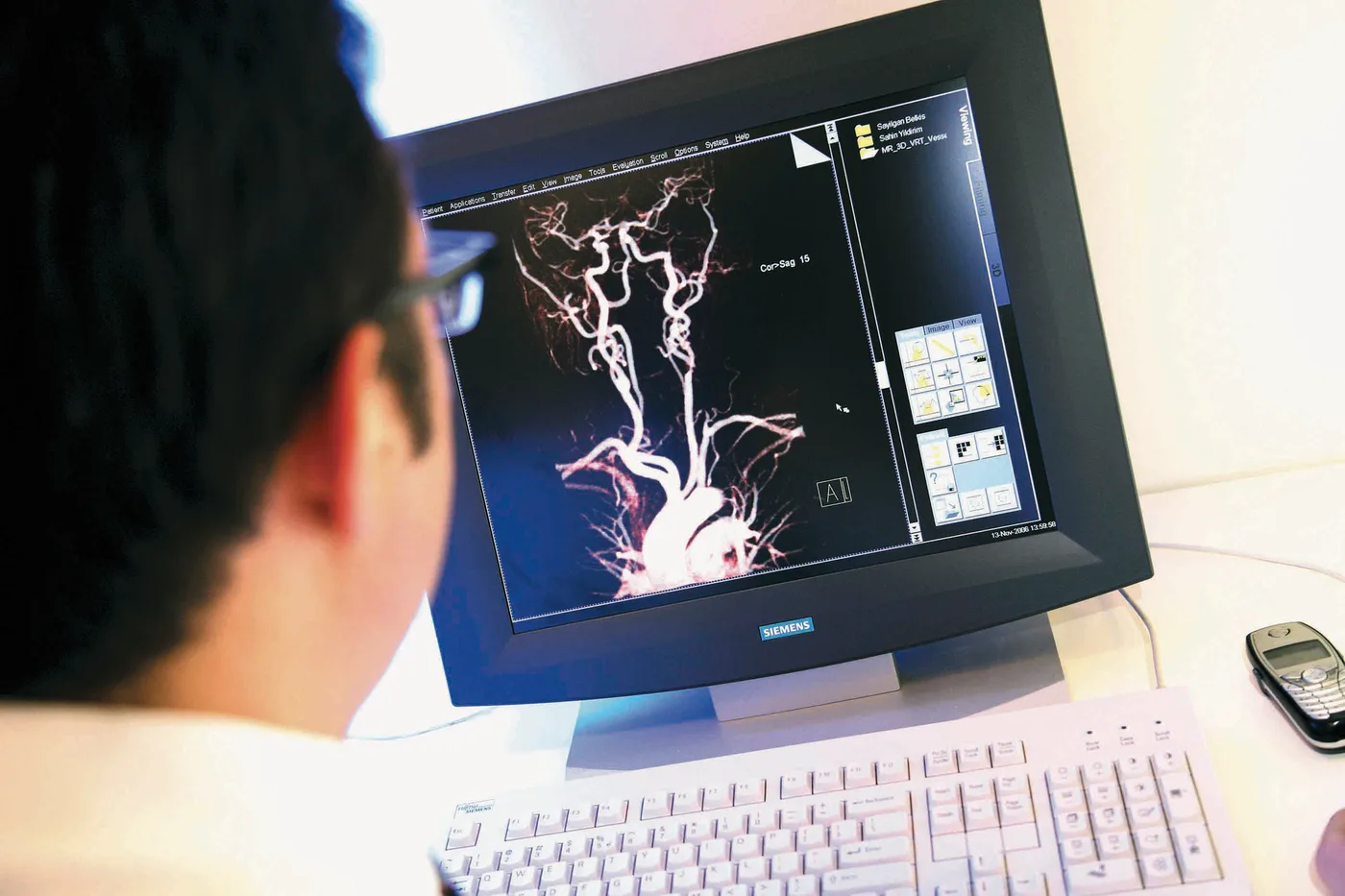 Radiologie neuro-interventionnelle à l'Anadolu Medical Center